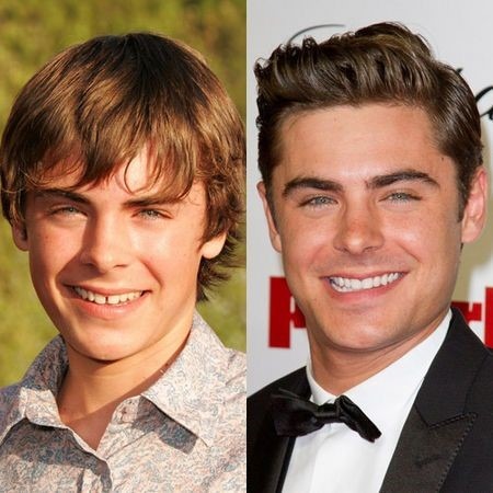 Zac Efron: promoting dental hygiene